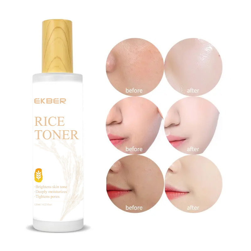Face Moisturizer Lotion Rice Toner for Dry Skin