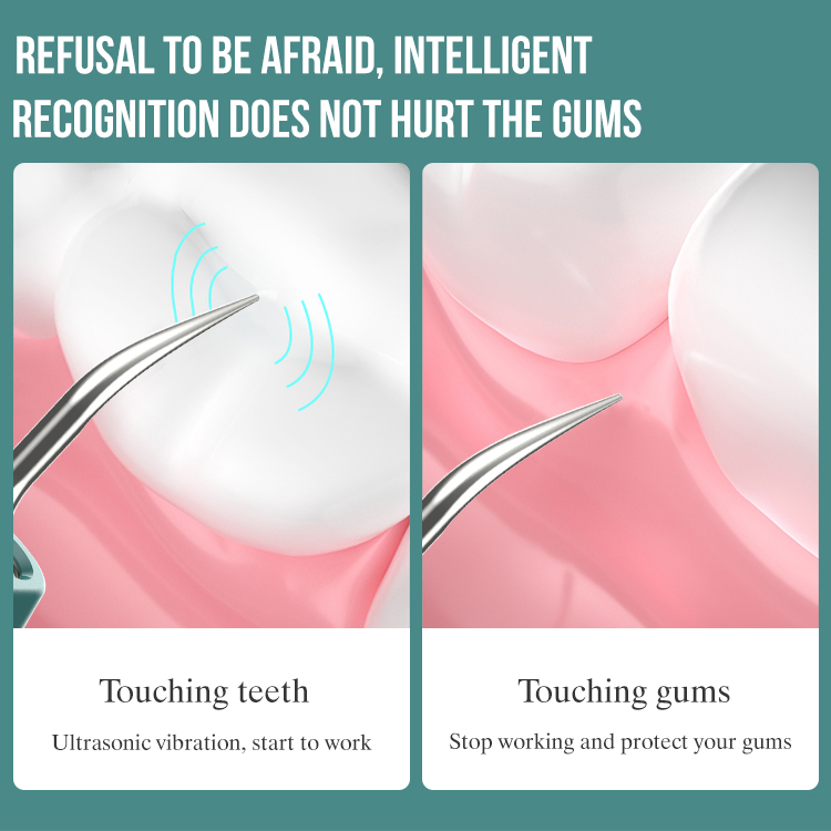 Jssan New Dental Visible Electric Sonic Tooth Cleaner Smart APP Plaque Calculus Remover Oral Camera