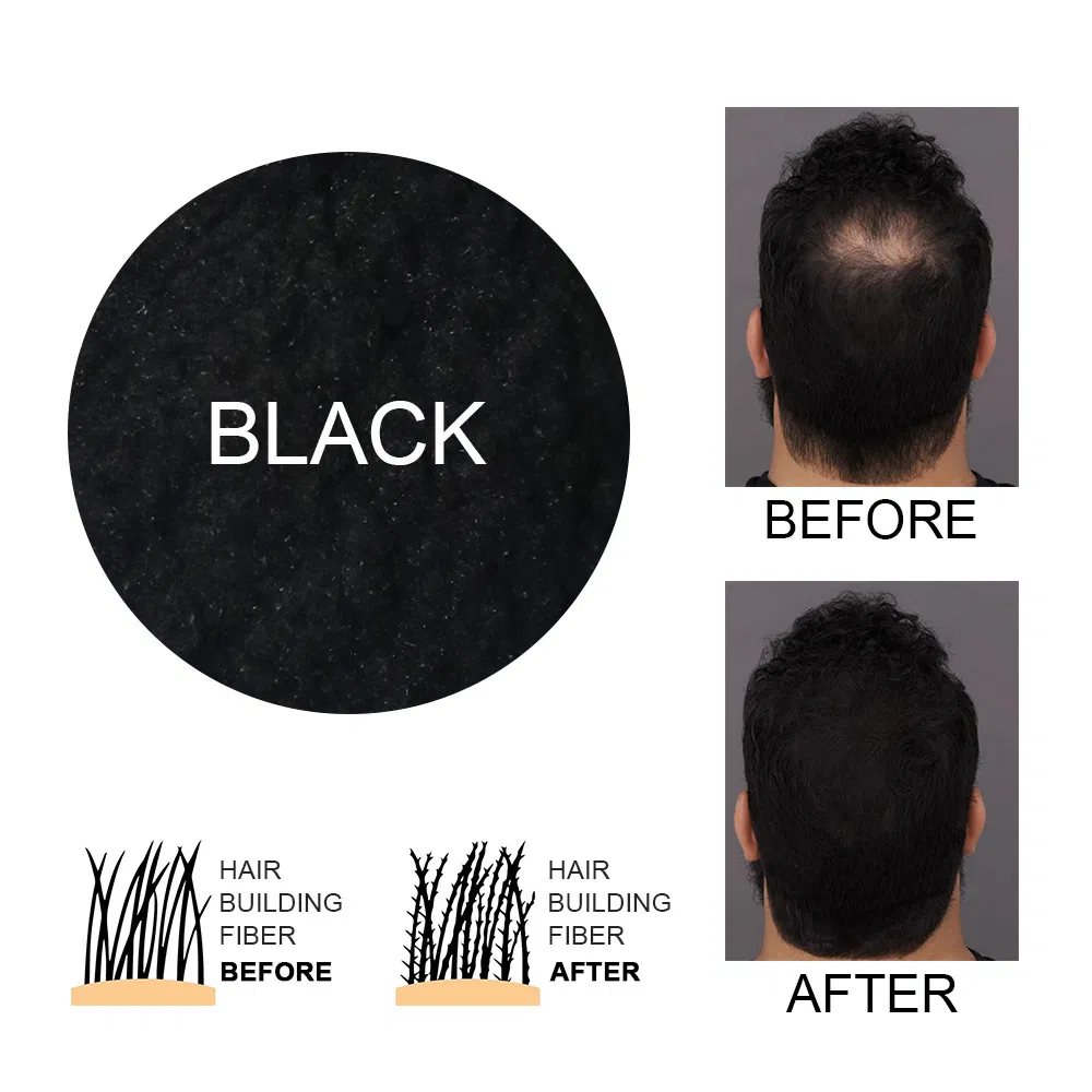 Conceals Hair Loss Hair Building Fibers