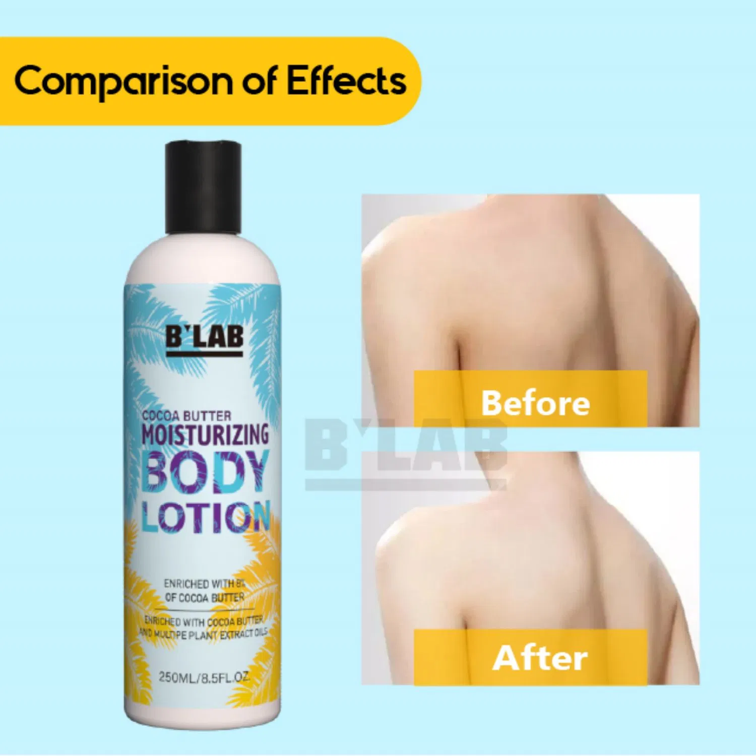 OEM/ODM Moisturizer Body Cream Body Lotion for Dry Skin & Itchy Skin