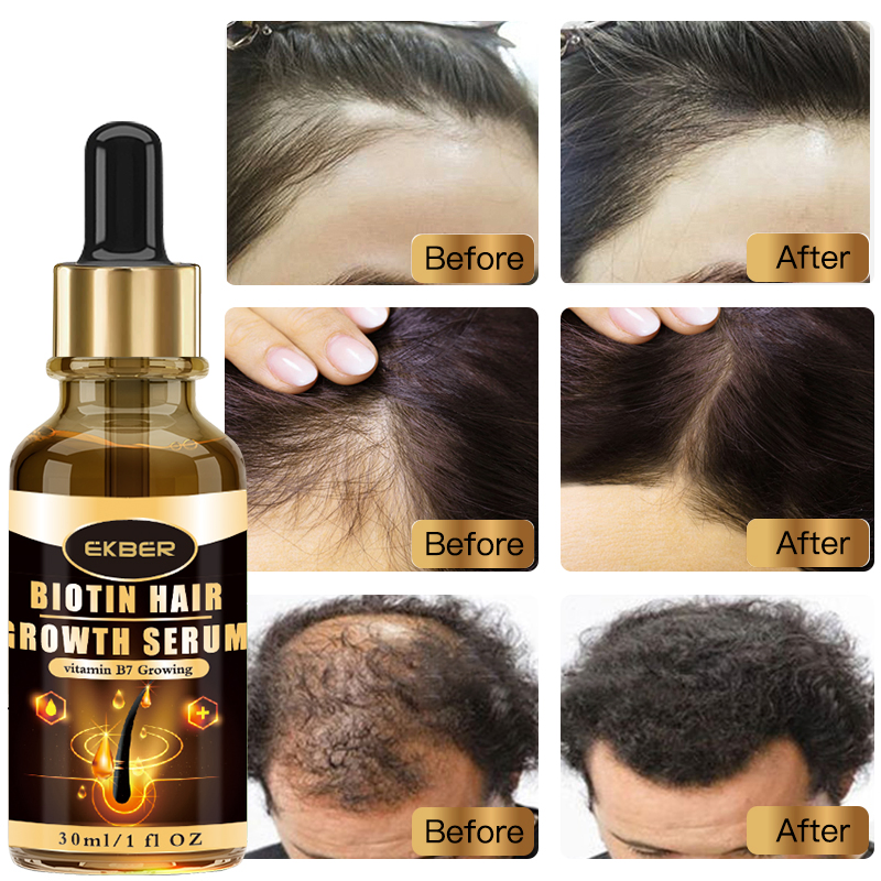 Private Label Biotin Hair Growth Serum Anti Loss Repair Scalp for Hair Growth Serum for Men and Women