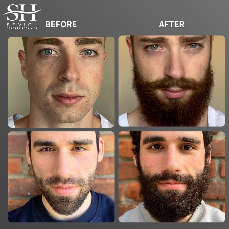 Private Label Natural Chebe Powder Vegan Smooth Hair Oil Men Care Beard Growth Oil for Hair Growth