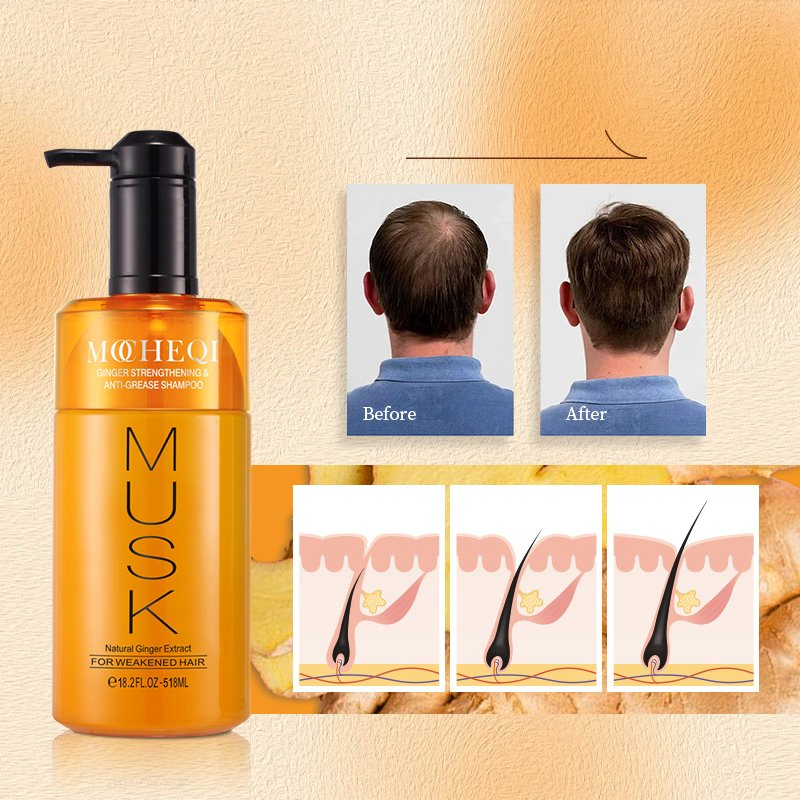 Mocheqi Best Seller Custom Organic Ginger Hair Growth Shampoo Private Label Anti Loss Hair Shampoo and Conditioner