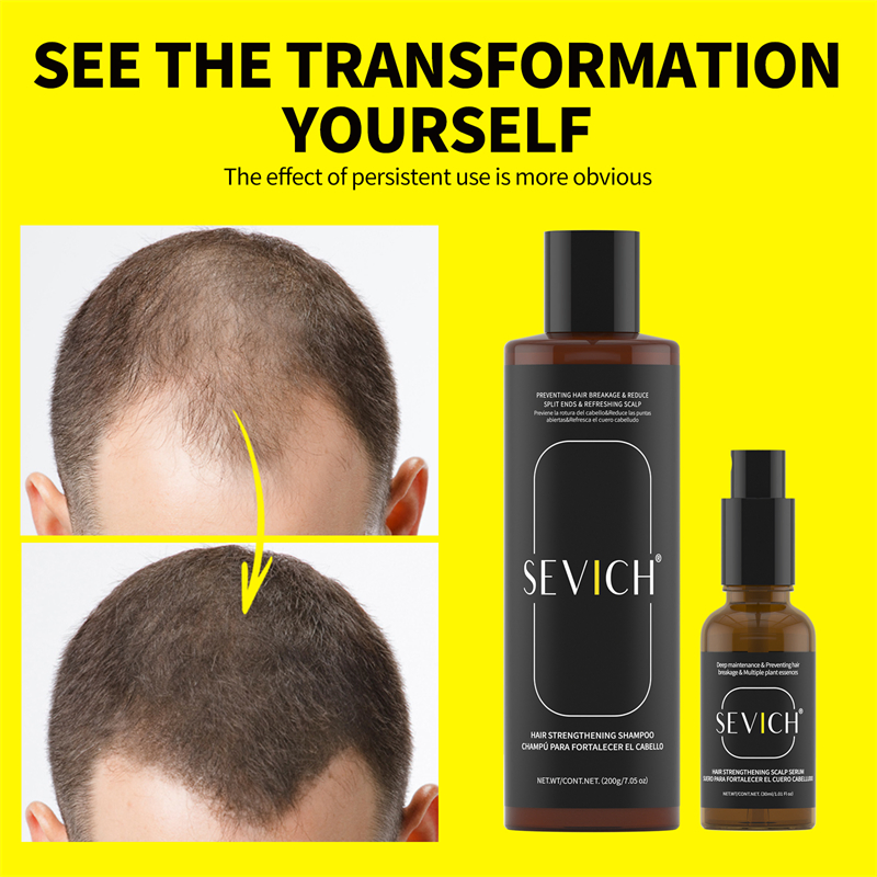 Hair Shampoo Set Wholesale Biotin Rosemary Hair Growth Serum Ginger Natural Anti Hair Loss Essential Oil and Shampoo