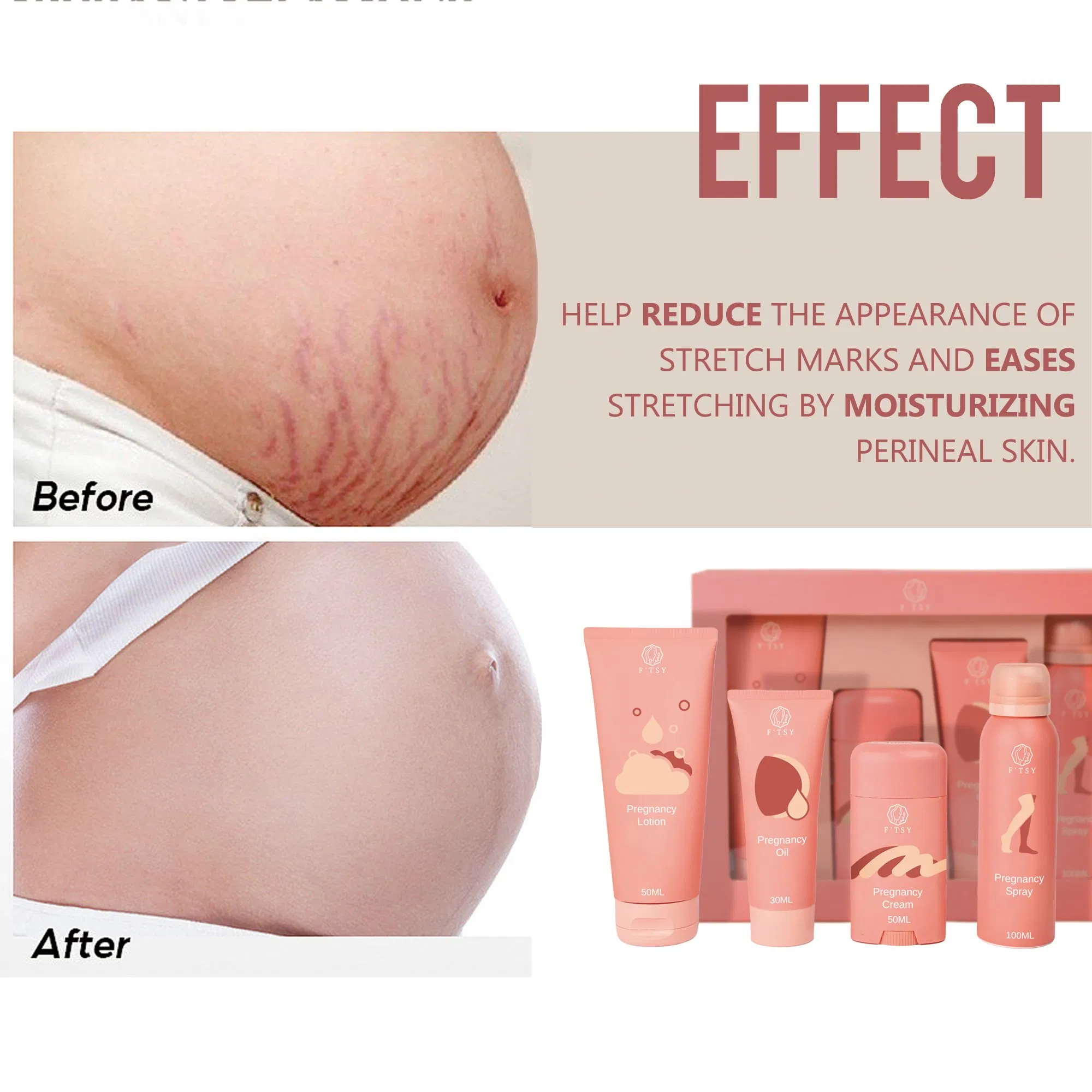 Private Label Soothing Nourishing Repairing Pregnant Skincare Set