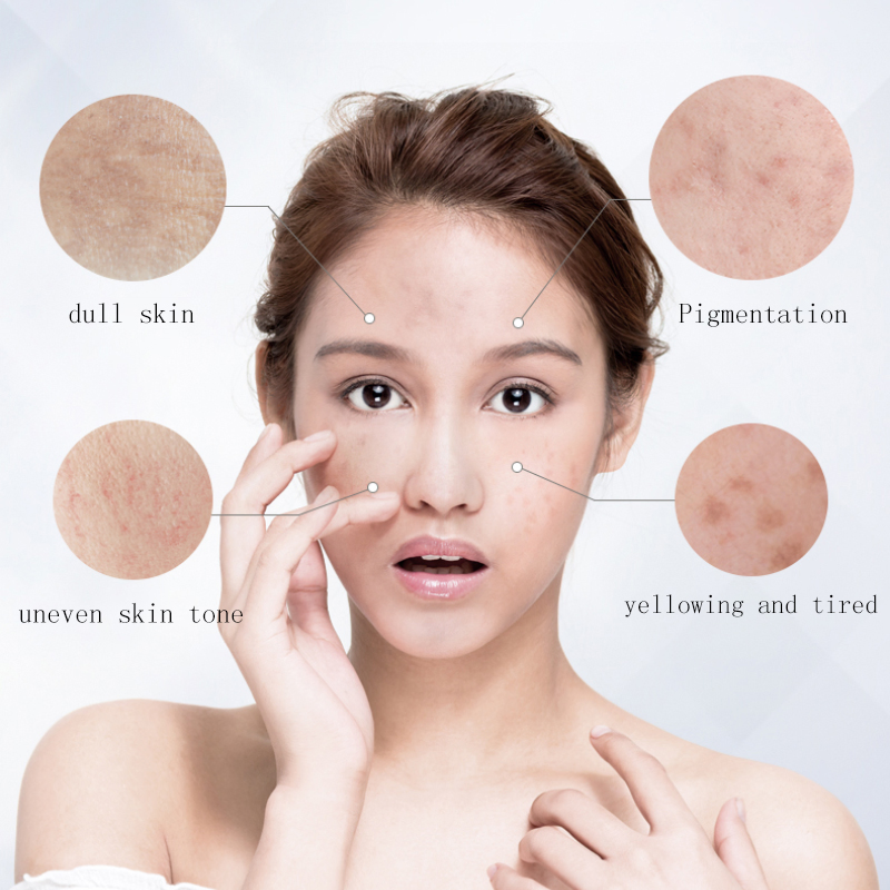 Anti Acne Dark Spot Remover Brightening Whitening Vitamin C Facial Essence Powder