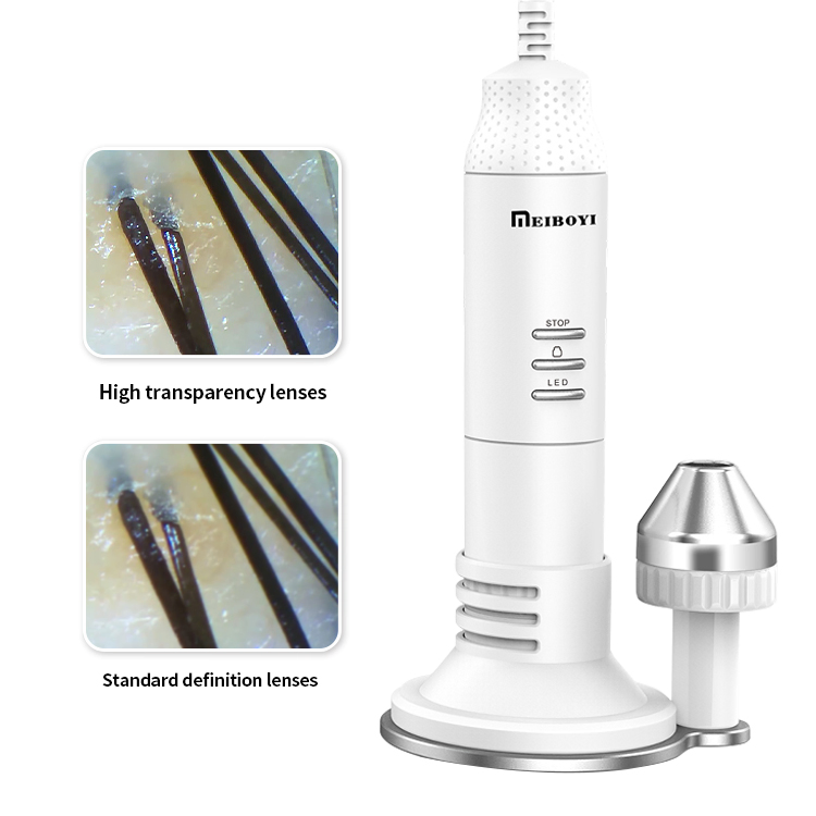 Сканер кожи головы для диагностики волос