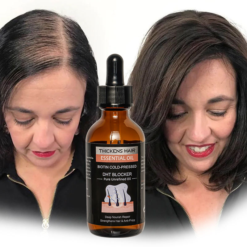 Fatazen Hair Growth Serum Oil Biotin Regrowth Treatment for Scalp Hair Loss Thinning Hair Growth Serum for Men Women