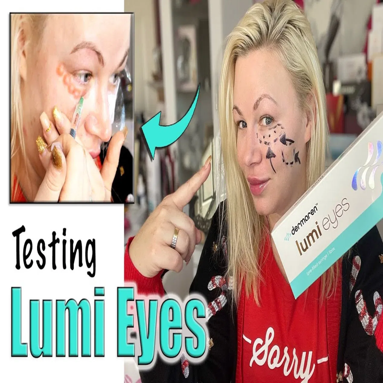 Korea Dermaren Lumi Eyes Eye Bag Black Circletreatment Pdrn Anti-Aging Wrinkles Skin Whitening Rejuvenation with Best Price