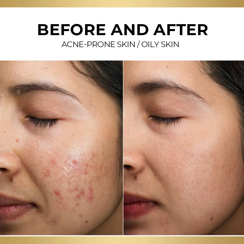 Herbal Moisturizer Exosome Eye Cream Anti-Aging Anti-Wrinkle Eye Bags Dark Circles Removal