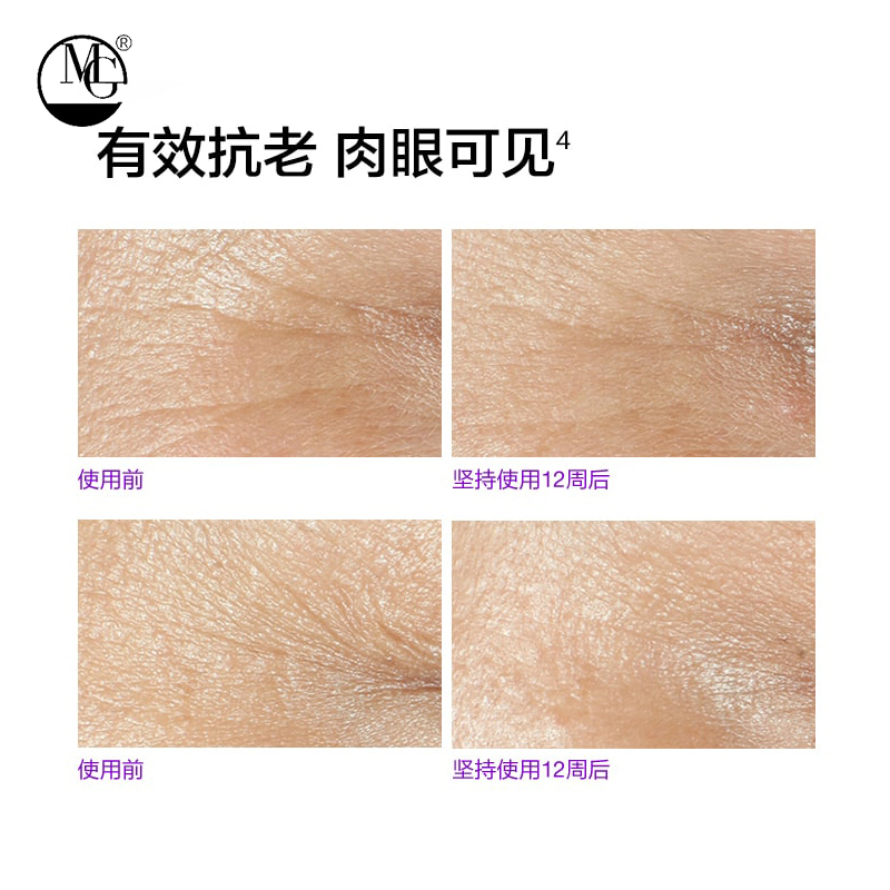 Vitamin C for Brightening and Firming Anti-Puffiness Eye Cream