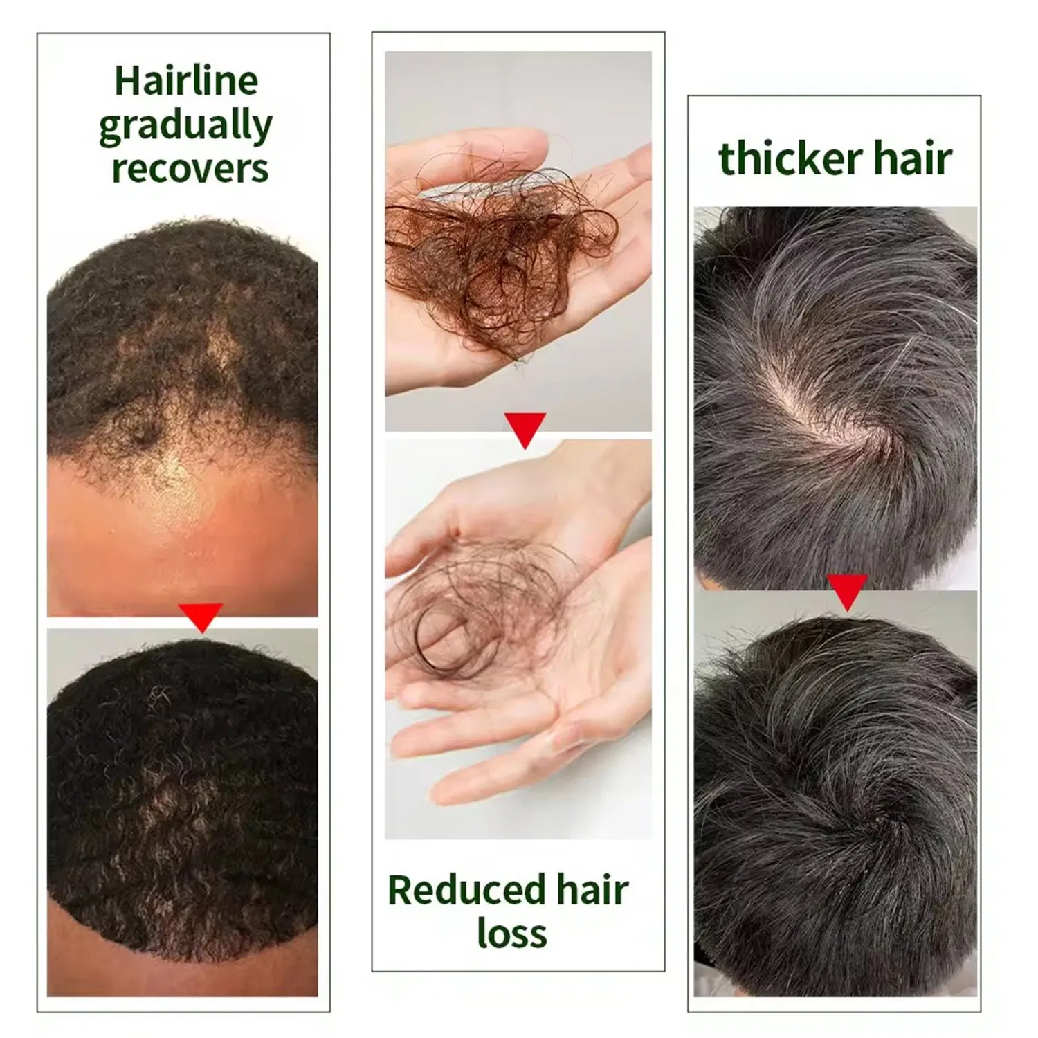 Natural Organic Scalp Vegan Black Hair Care Essential Oil