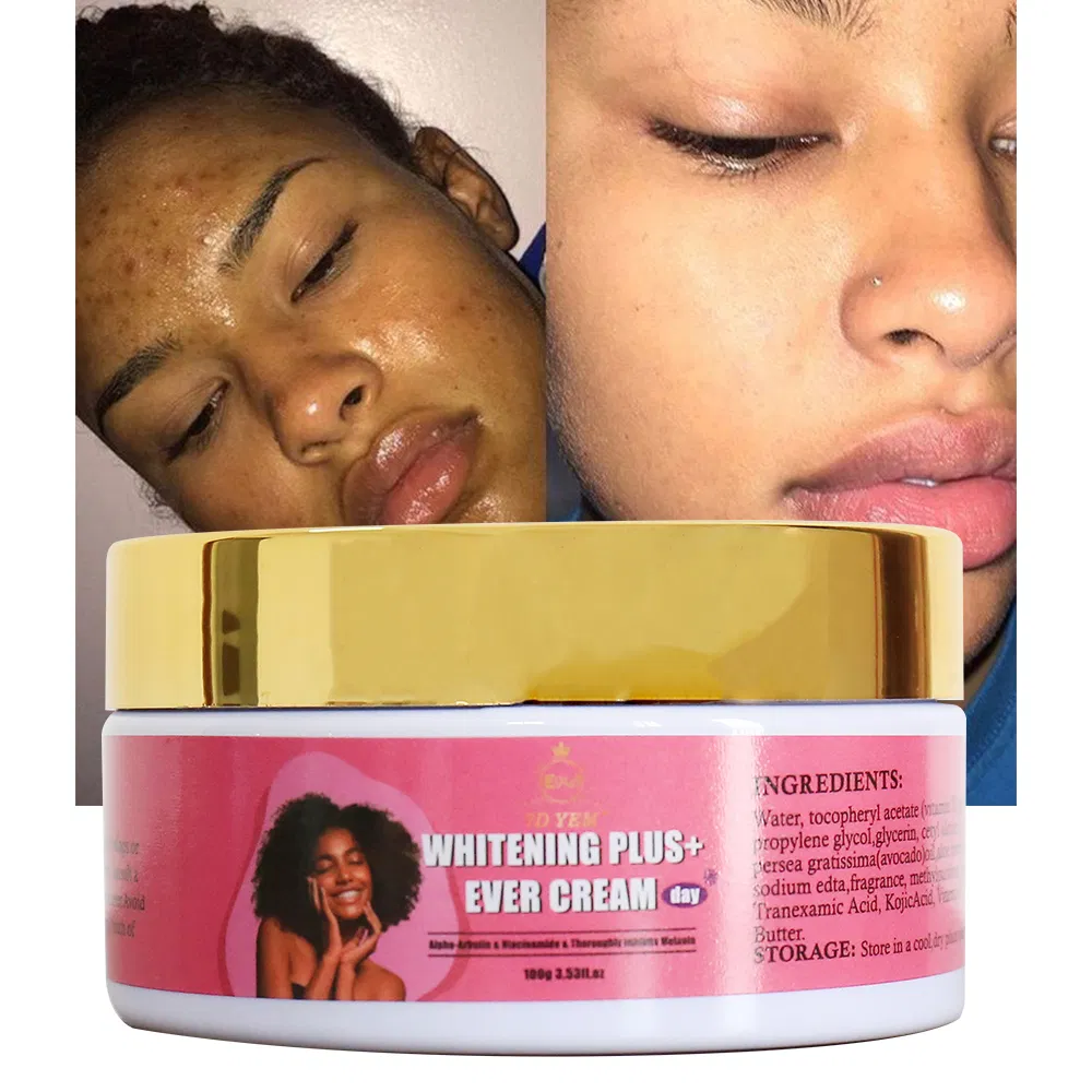 Private Label Skin Brightening Face Cream Anti Acne Mark Anti Aging Whitening Face Creams to Remove Dark Spots