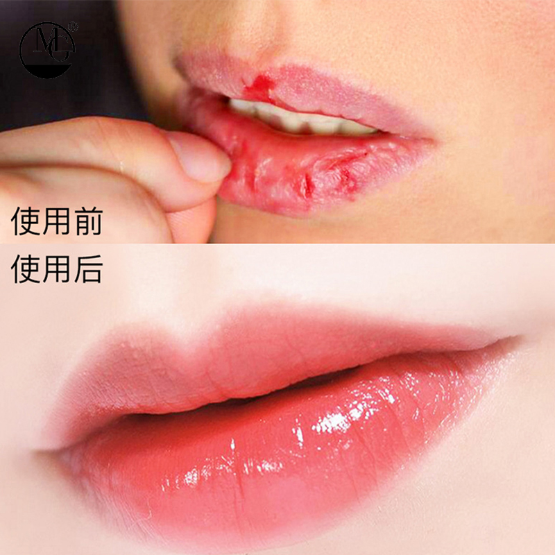 Non-Stick Cherry Lip Balm for Healthy, Hydrated Lips
