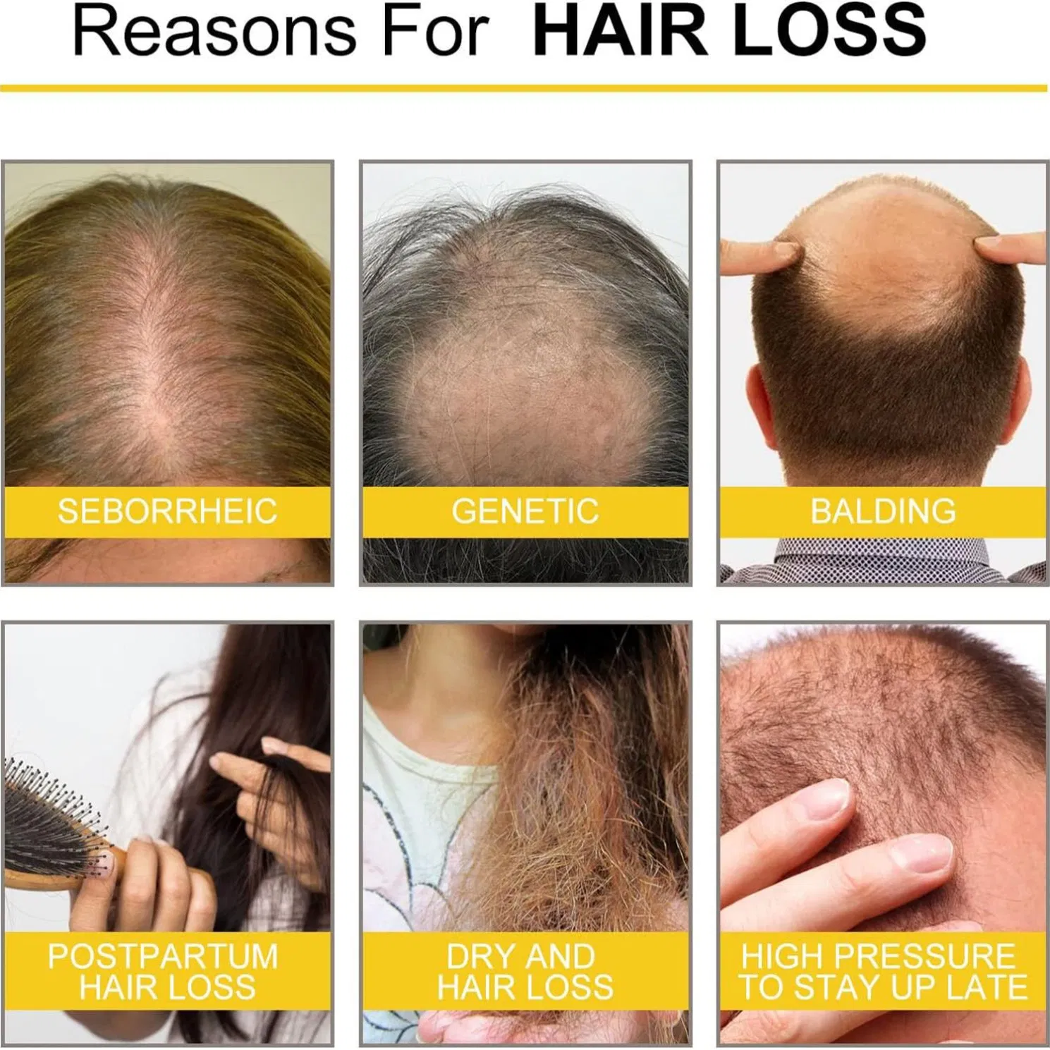 Hair Regrowth Serum Reduces Shedding Boosts Thickness for Thinning Hair