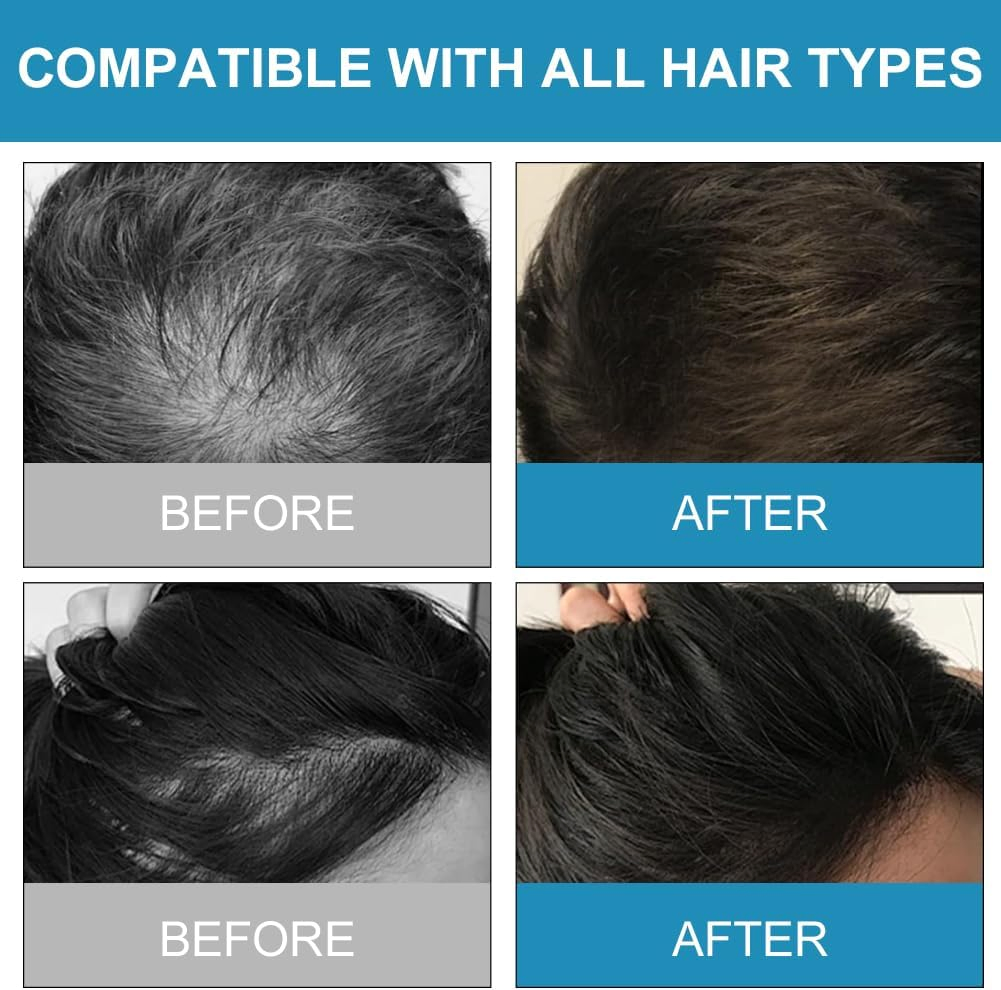 Stimulate Hair Regrowth Fuller Thicker Mane From Natural Nourishment