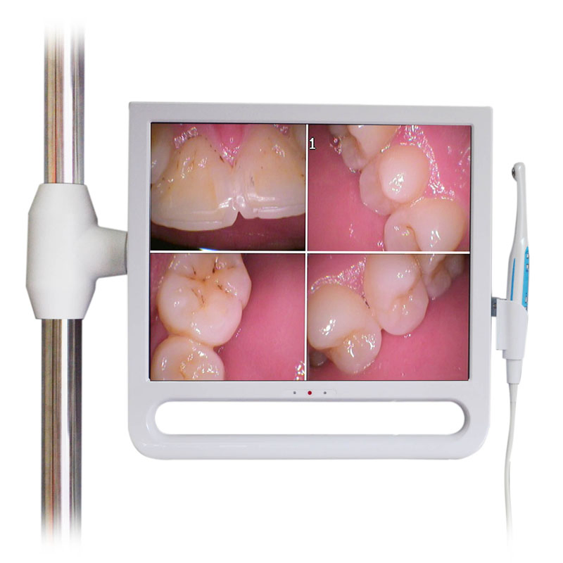 Best VGA Dental Intraoral Camera with 17 Inch Screen System Connect for Dental Unit