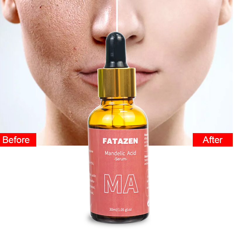 Reduce Acne Marks Repairing Shrink Pores Faded Spot Mandelic Acid Facial Serum