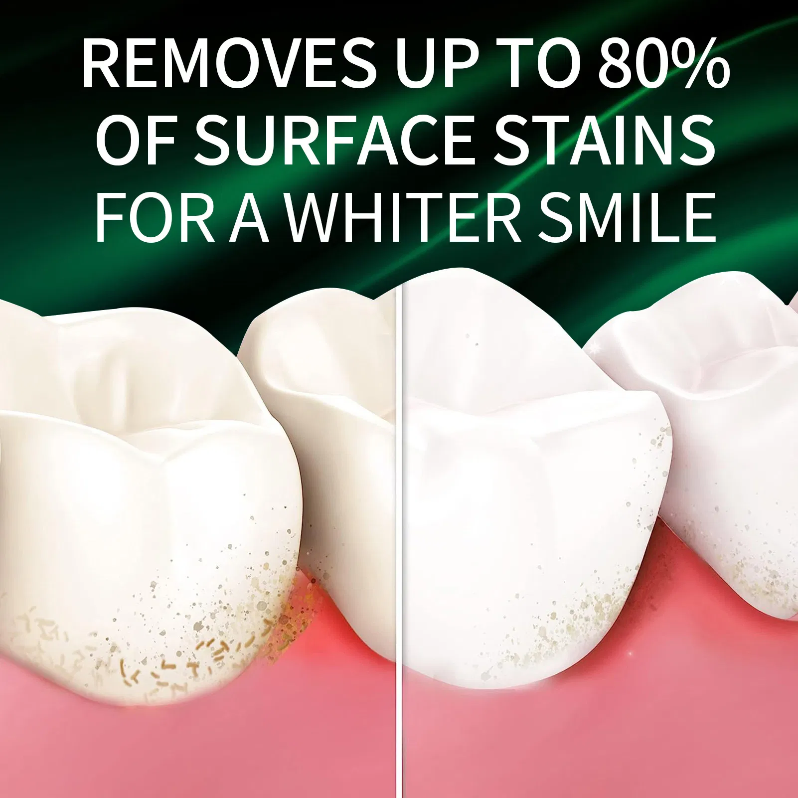 OEM Wholesale High Quality Toothbrush Teeth Whitening