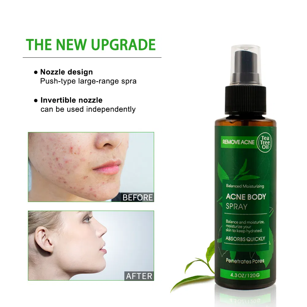 Private Label Tea Tree Oil Extract Treatment Spray Facial Mist Anti-Acne Remover Glowing Whitening Hydrating Face Body Spray