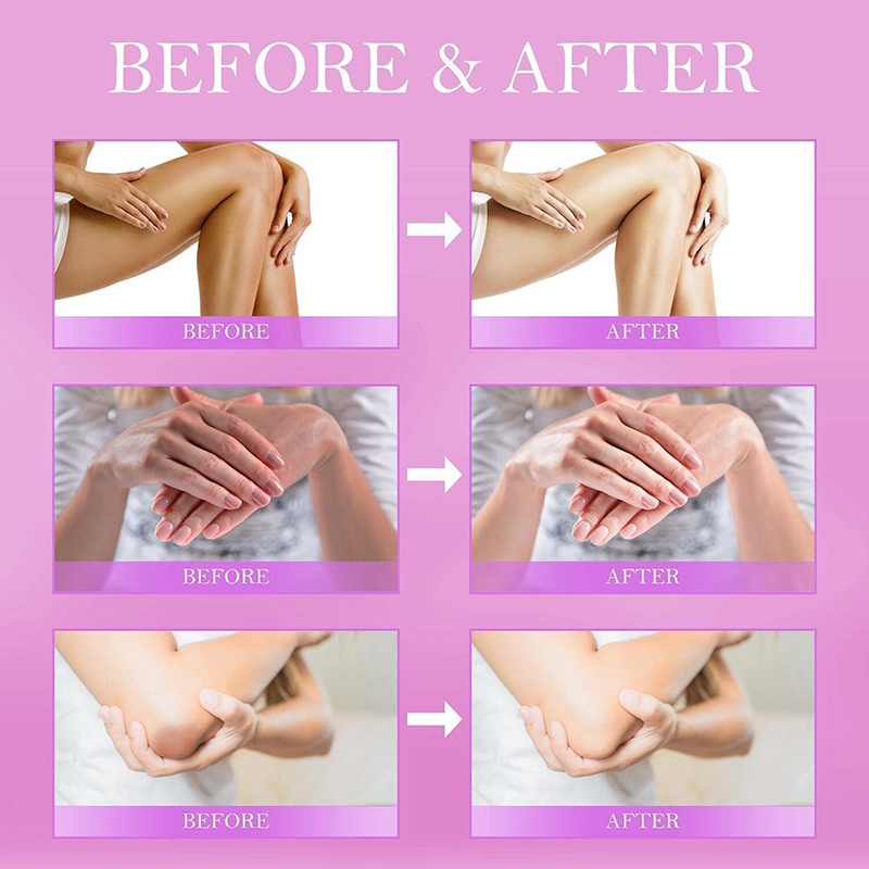 Best Price Body Armpit Whitening Cream Lightening Body Under Arm Black Skin Uses Available Cheap for Armpit Cream