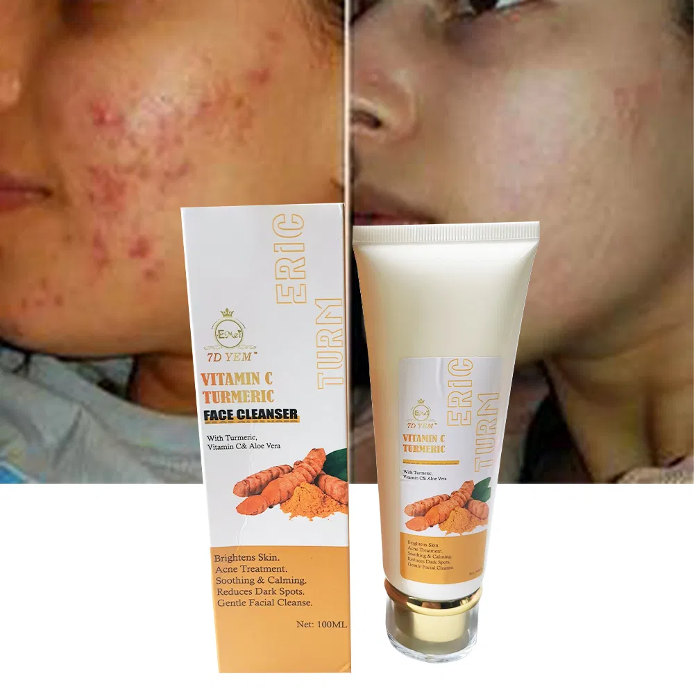 Natural Organic Mild Cleansing Turmeric Extract Cleanser Rich Foam Refreshing Oily Skin Moisturizing Cleanser with Vitamin C