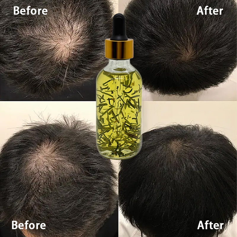 60ml Olive Oil Rosemary Essential Oil Hair Care Regrowth Herbal Anti Hair Loss Hair Plant Extract Essential Oil Serum