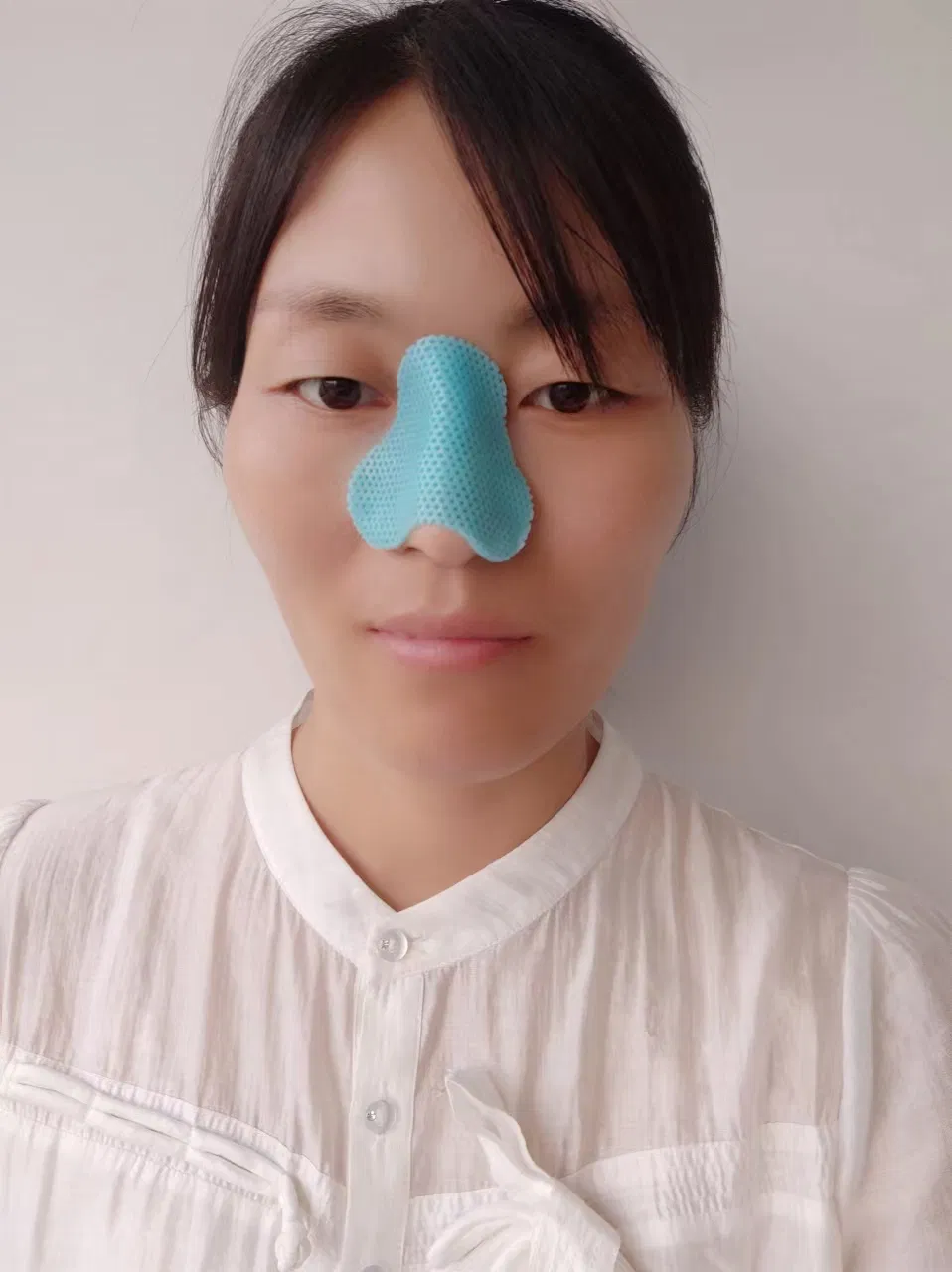 External Thermoplastic Nasal Splint Fracture Nose Plaster