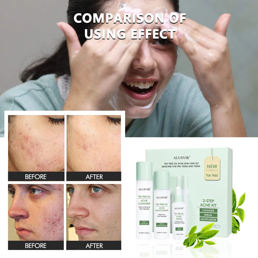 Natural Organic Tea Tree Moisturising Skincare Set for Children's Acne