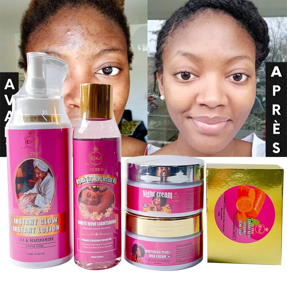 Effective Whitening Acne Skin Care Set for Caramel Skin Private Label Brightening Hydrating Natural Herbal Carotene Skin Care Sets