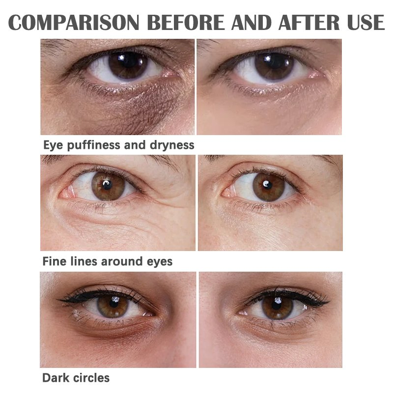 Best Selling and Price Product Collagen Hydrogel Eye Gel Patch Good Product High Quality Collagen Eye Mask