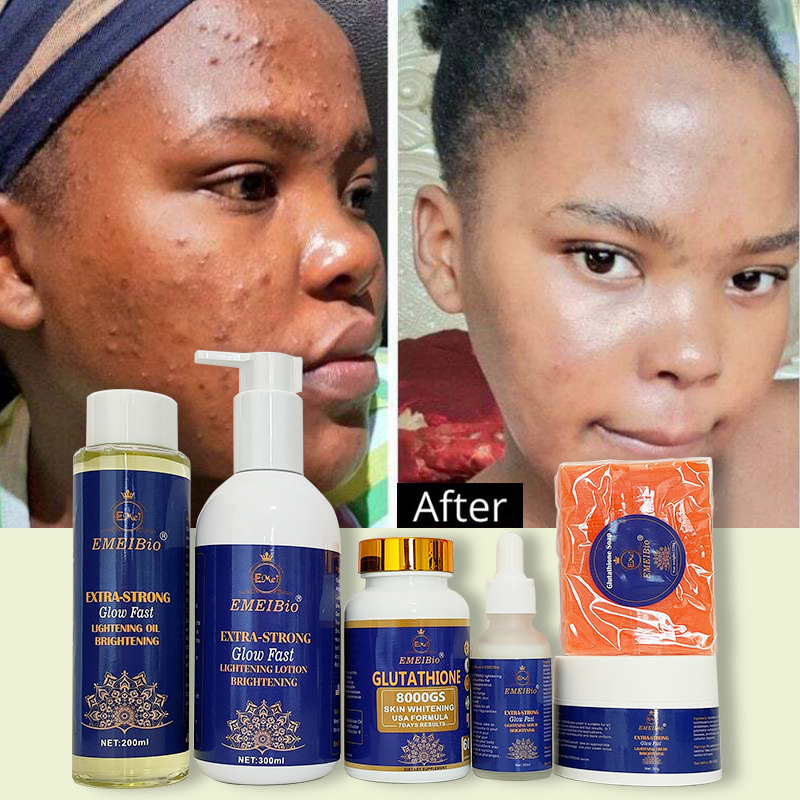 OEM Strong Whitening and Moisturizing Skincare Set Body Lotion Serum Cream Soap Whitening Skincare