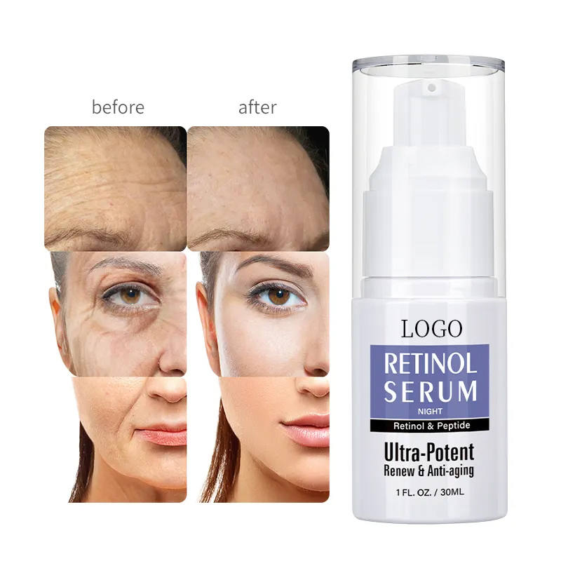 Private Label OEM Skin Care Anti Aging Wrinkle Brightening Hyaluronic Acid + Vitamin E Face Retinol Serum