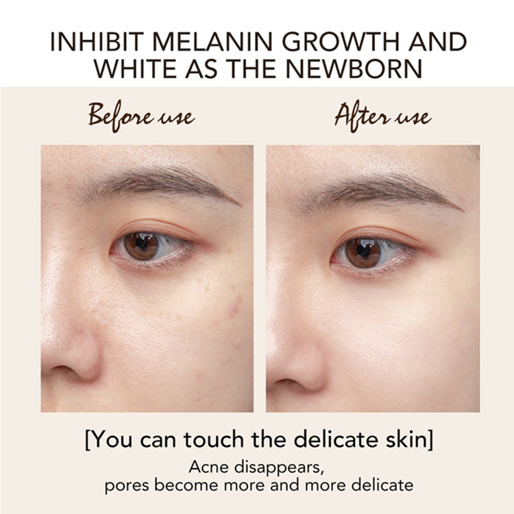 OEM Custom Kojic Acid Bleaching Cream Black Skin Whitening Night Cream