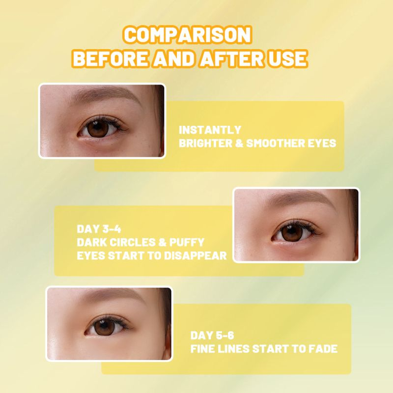 Private Label Factory Wholesale Natural Nourishing Vitamin C 24K Gold Wrinkle Remover Eye Mask