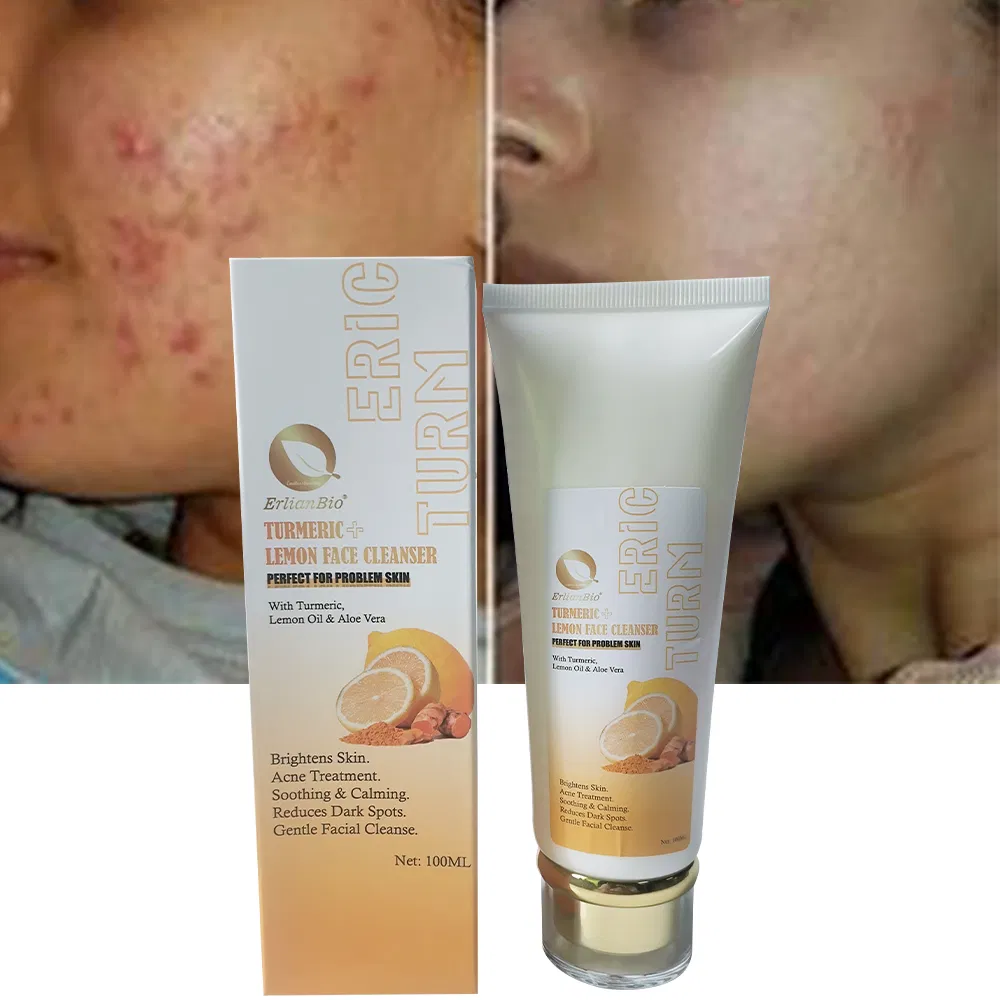 Personal Label Facial Cleanser Quick Cleaning Removal Acne Scars Whitening Skin Brightening Hydrating Turmeric Face Cleanser