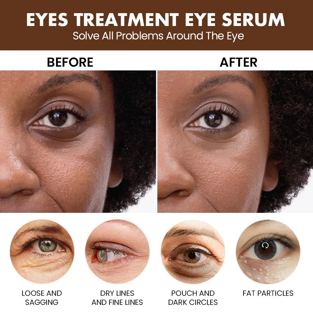 Eyes Care Multi Peptide Anti Aging Dark Circles Eye Cream