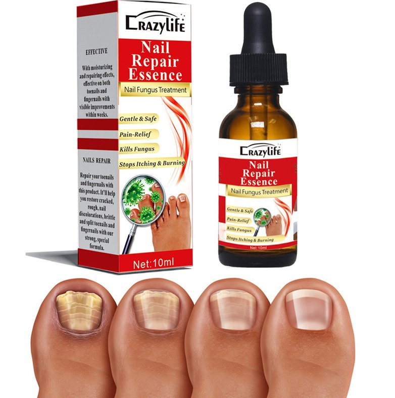 Online Wholesale Ready to Ship Spot Stock 10ml Effective Nail Repair Serum Essences Anti Fungus Remove Onychomycosis Toe Nourishing