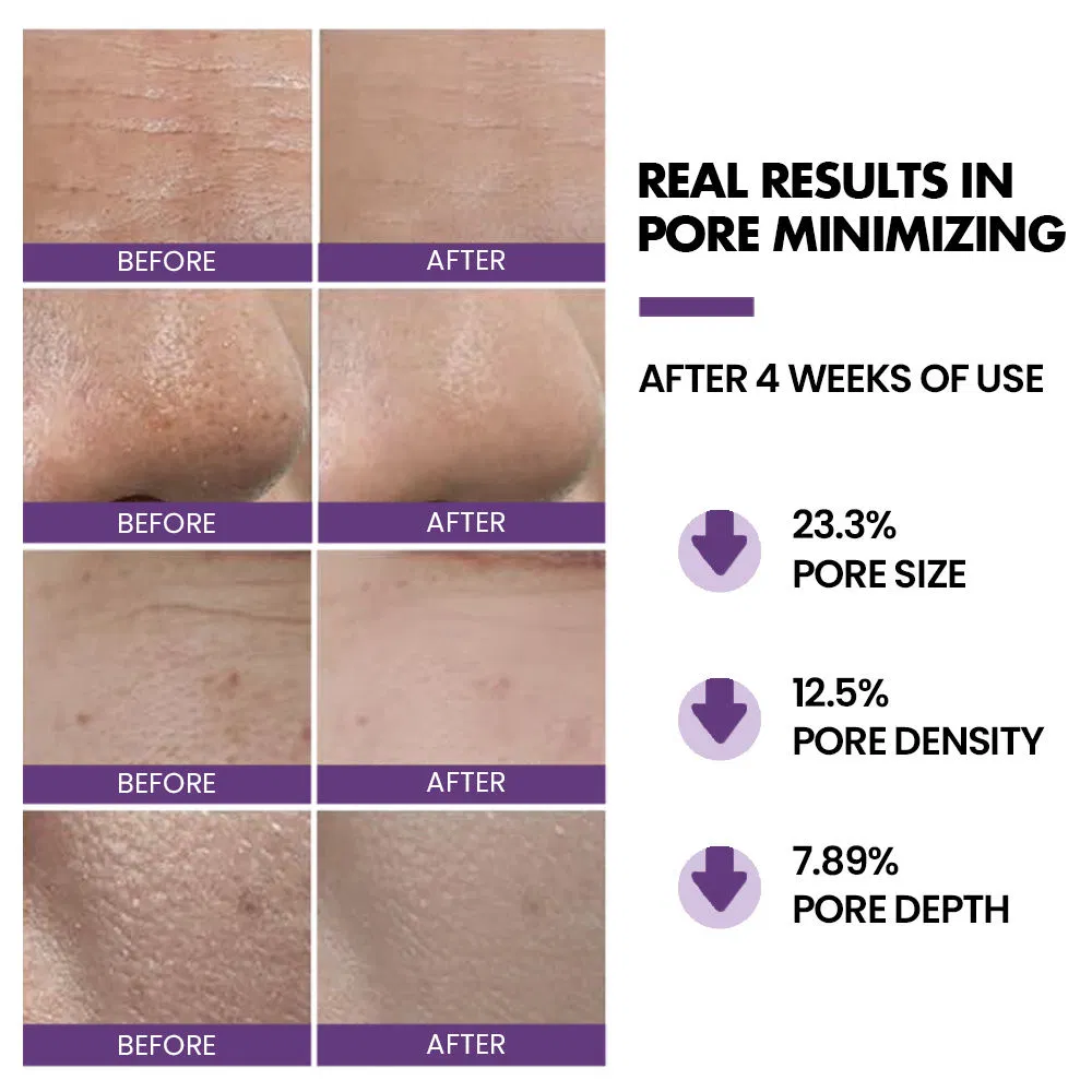 Vitamin E Anti Aging Shrink Pores Face Toner Spray Minimizer Facial Toner