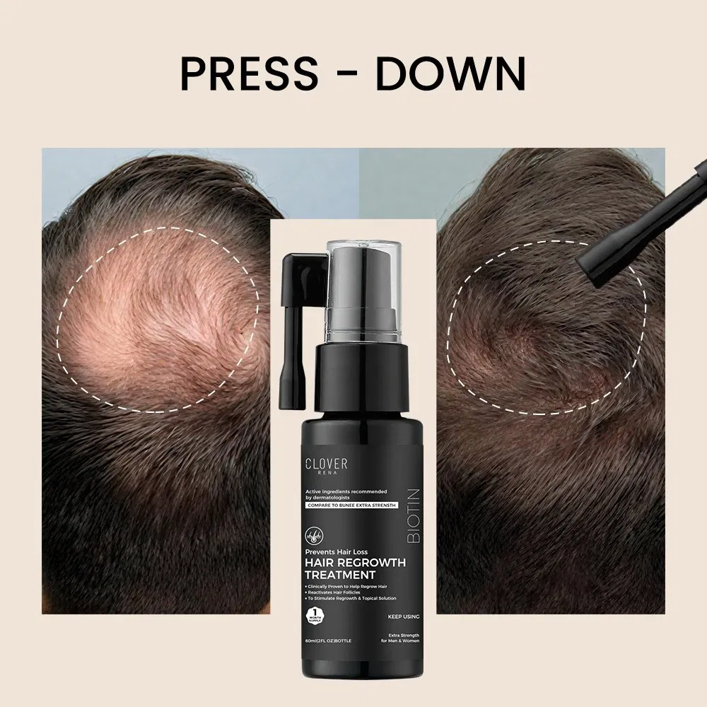 Organic Anti-Hair Loss Repair Serum Concentrated Formula Natural Vegan Ingredients Biotin Regenerated Oil Argan 60ml Treatment