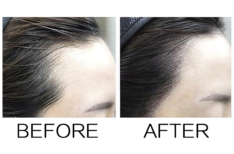 Top Selling Factory Price Instant Hairline Powder for Hair Care