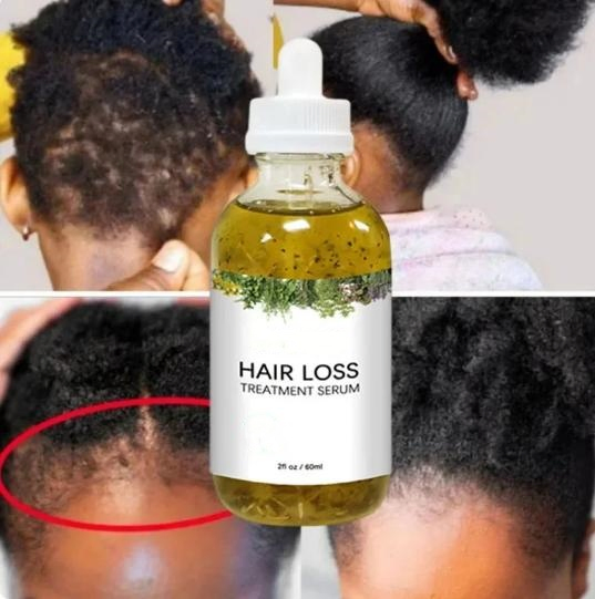 Private Label Natural Vegan Regrowth Hair Growth Anti Loss Serum for Women & Men