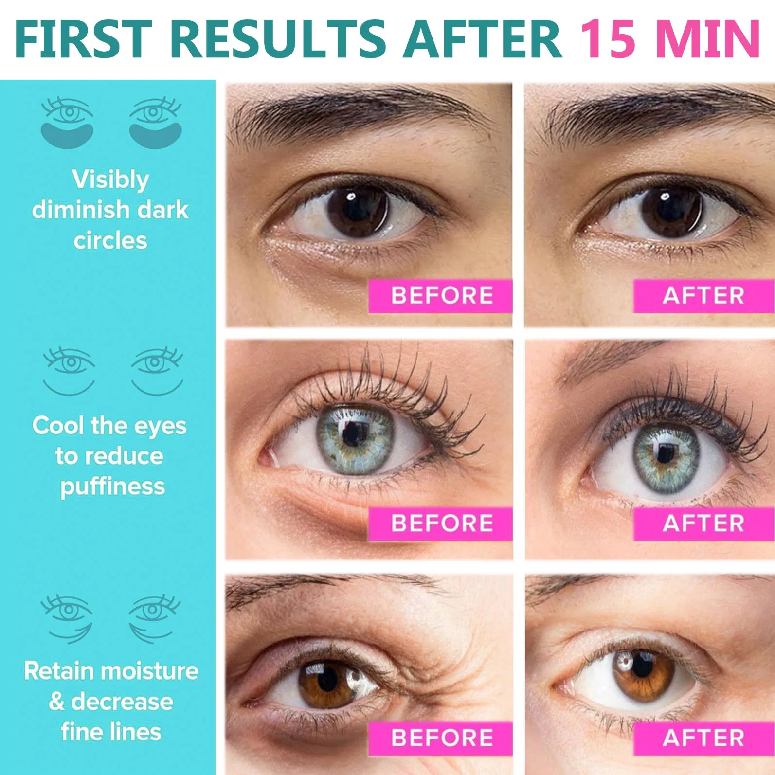 Eye Bags Treatment with Hyaluronic Acid Collagen Eye Masks