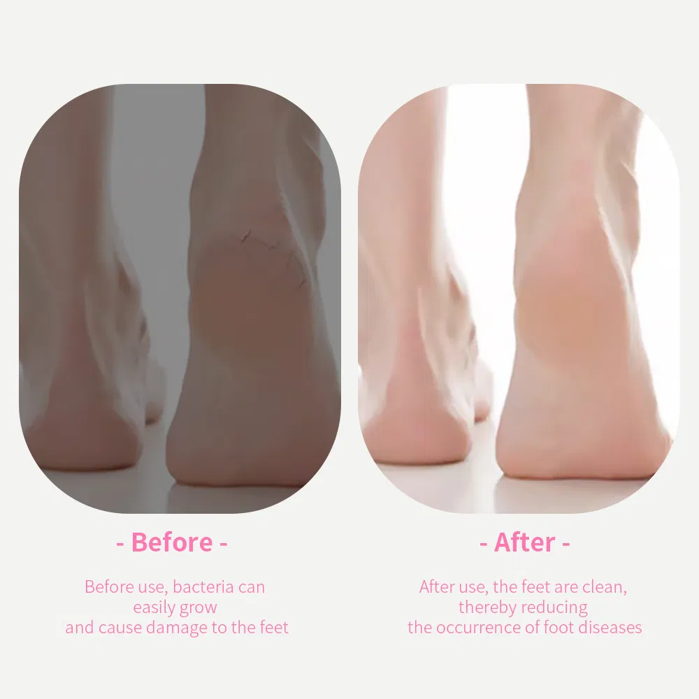 Multi-Function Pedicure Set Foot Grinder Dead Skin Shaving Board File Pedicure Knife Suit