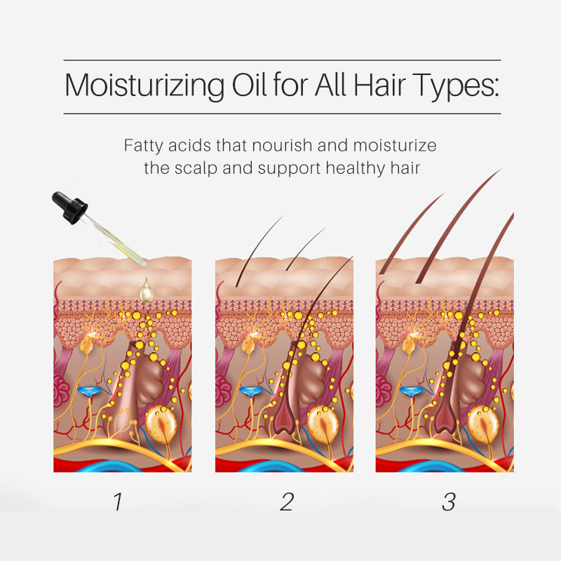 Onion Hair Oil for Promote Thickening Anti Loss Nourishing Hair Growth Oil Organic for Women Hair Treatment Essential Oil