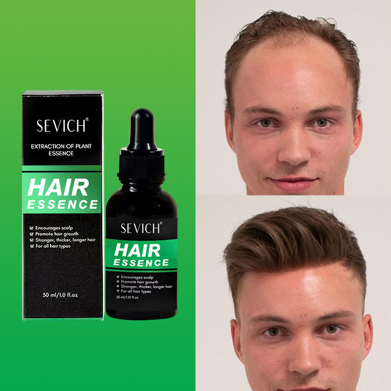 New Arrival OEM Herbal Ginger Ginseng Anti Hair Loss Treatment Scalp Care Hair Growth Essential Oil