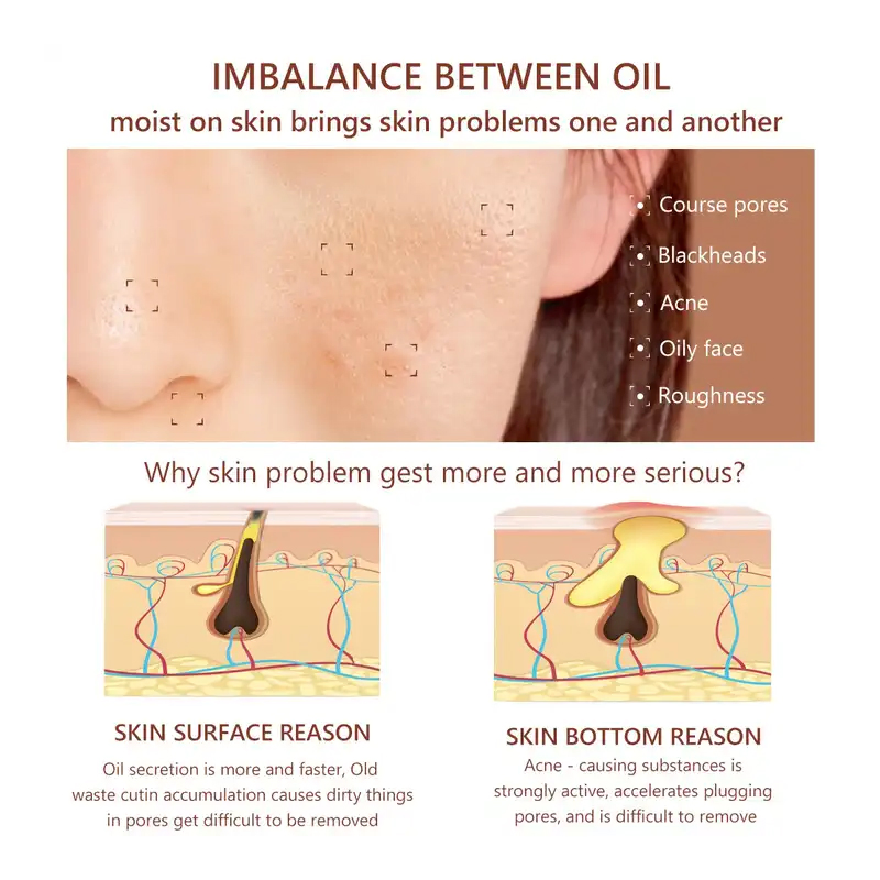 Ditong ODM Pores Treatment Skin Care Essence for Pore Shrinking and Anti Wrinkle