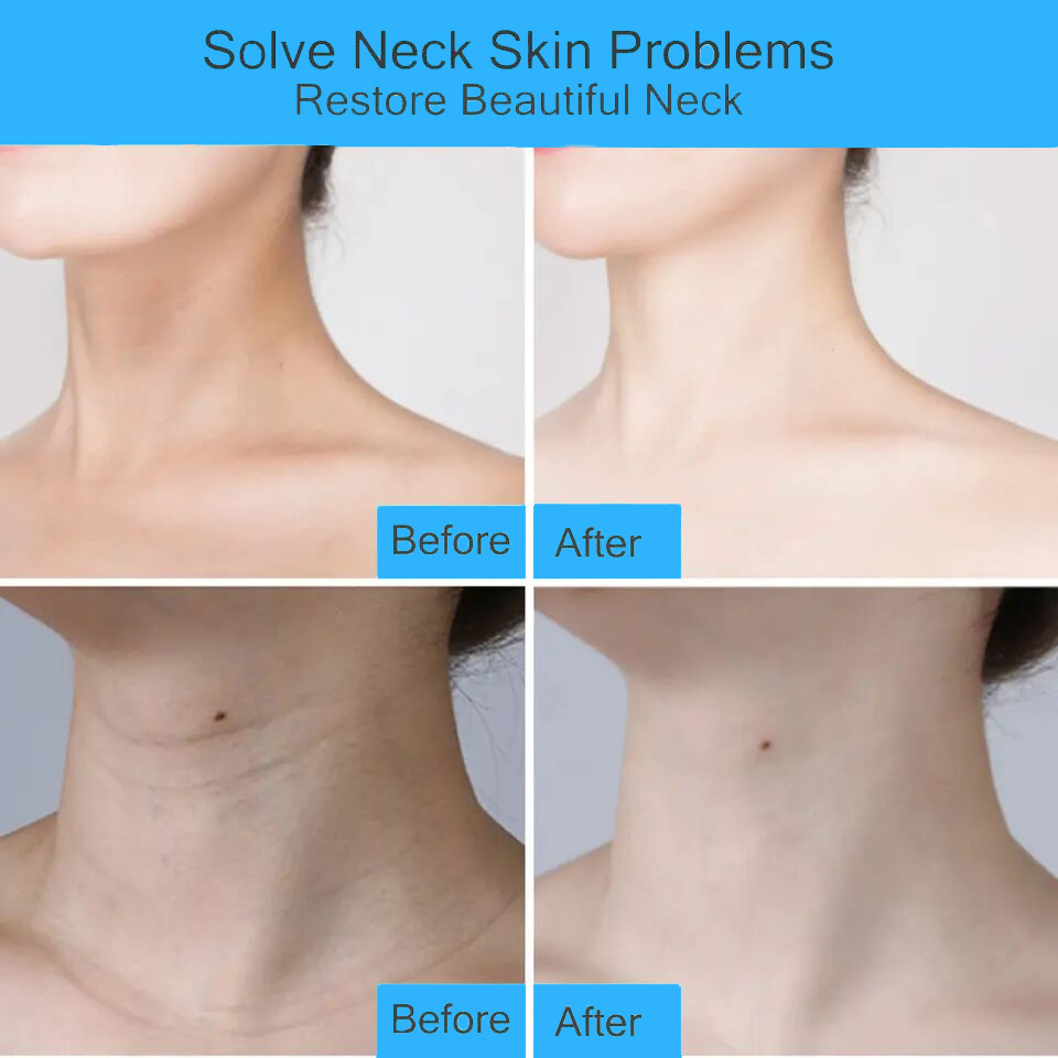 Radiant Neck and Face Whitening Cream for Smooth Skin