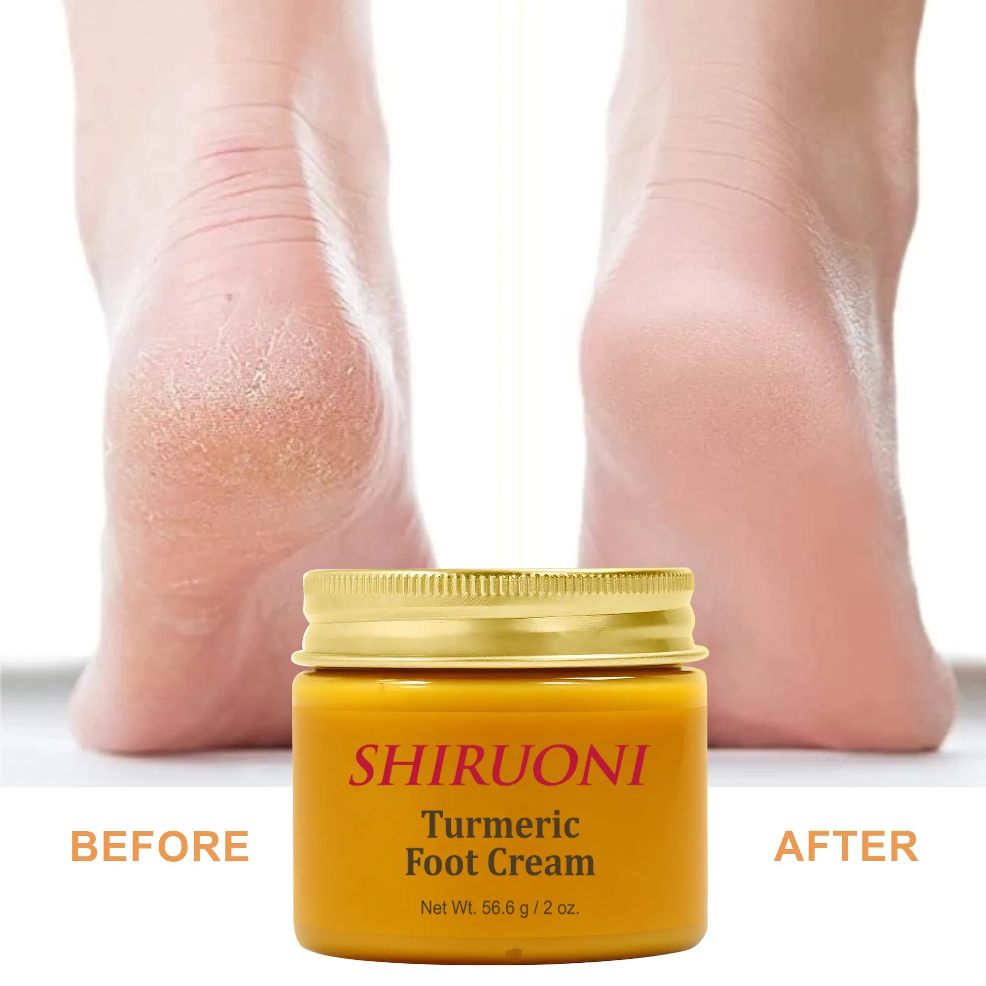 OEM Turmeric Foot Cream Hydrating Urea Cream