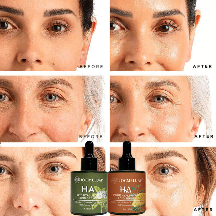 Private Label Face Anti Aging Serum Niacinamide Retinol Hyaluronic Acid Vitamin C Skin Care Facial Serum